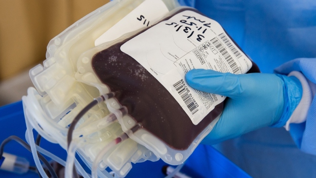Donar células madre: seguro, necesario y todavía un reto en Colombia