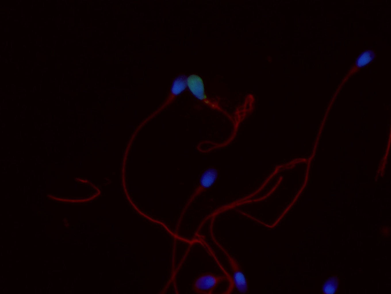 imagen de microscopio